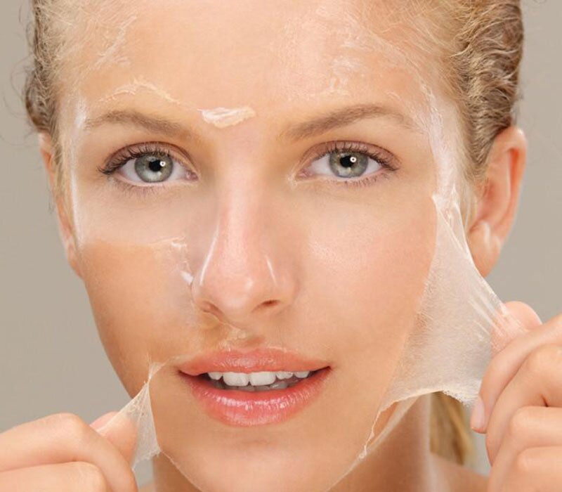 Chemical Peels in Delhi