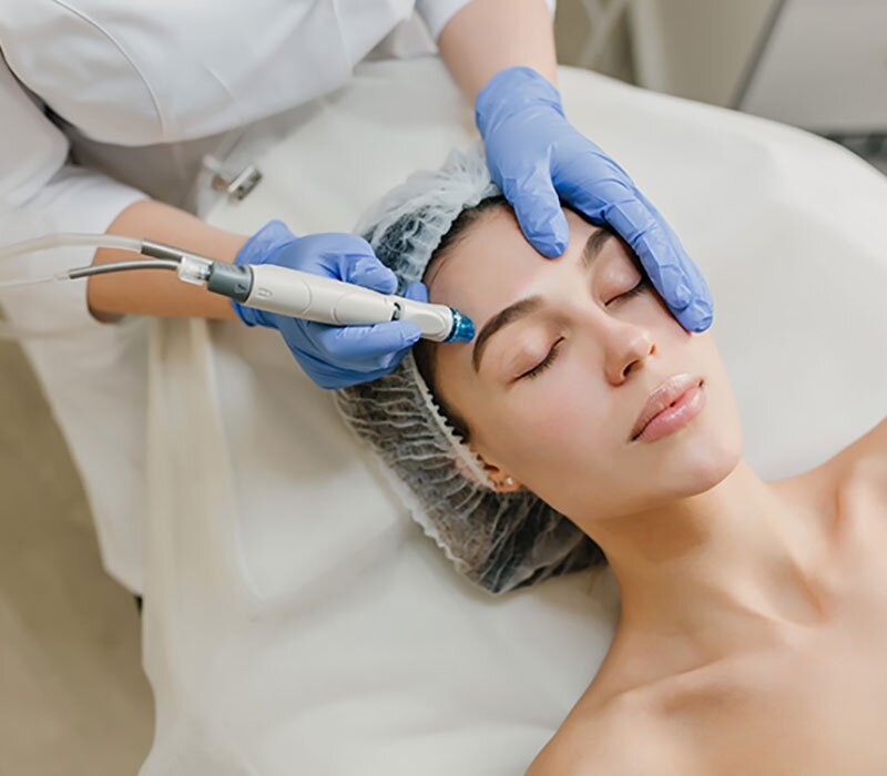 Mesotherapy in Delhi