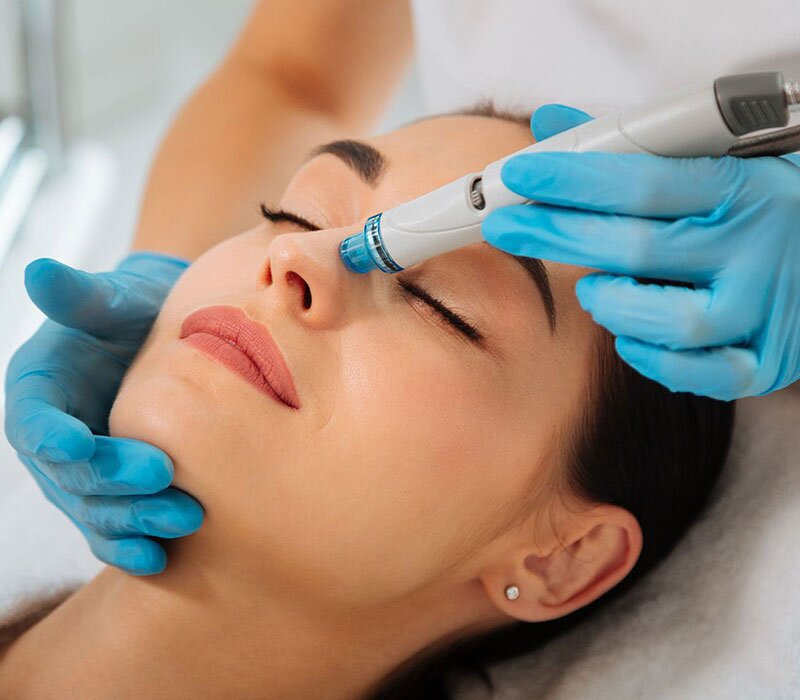 Hydrafacial Treatment in delhi