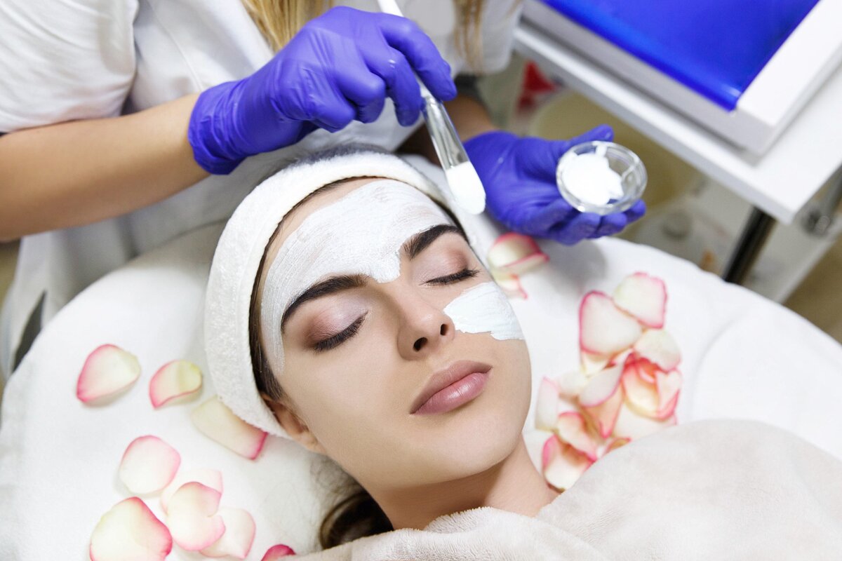 Chemical Peel for Hyperpigmentation