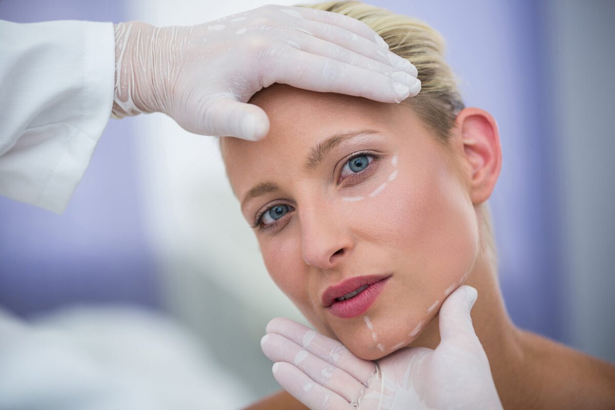 Thread Lift Treatment