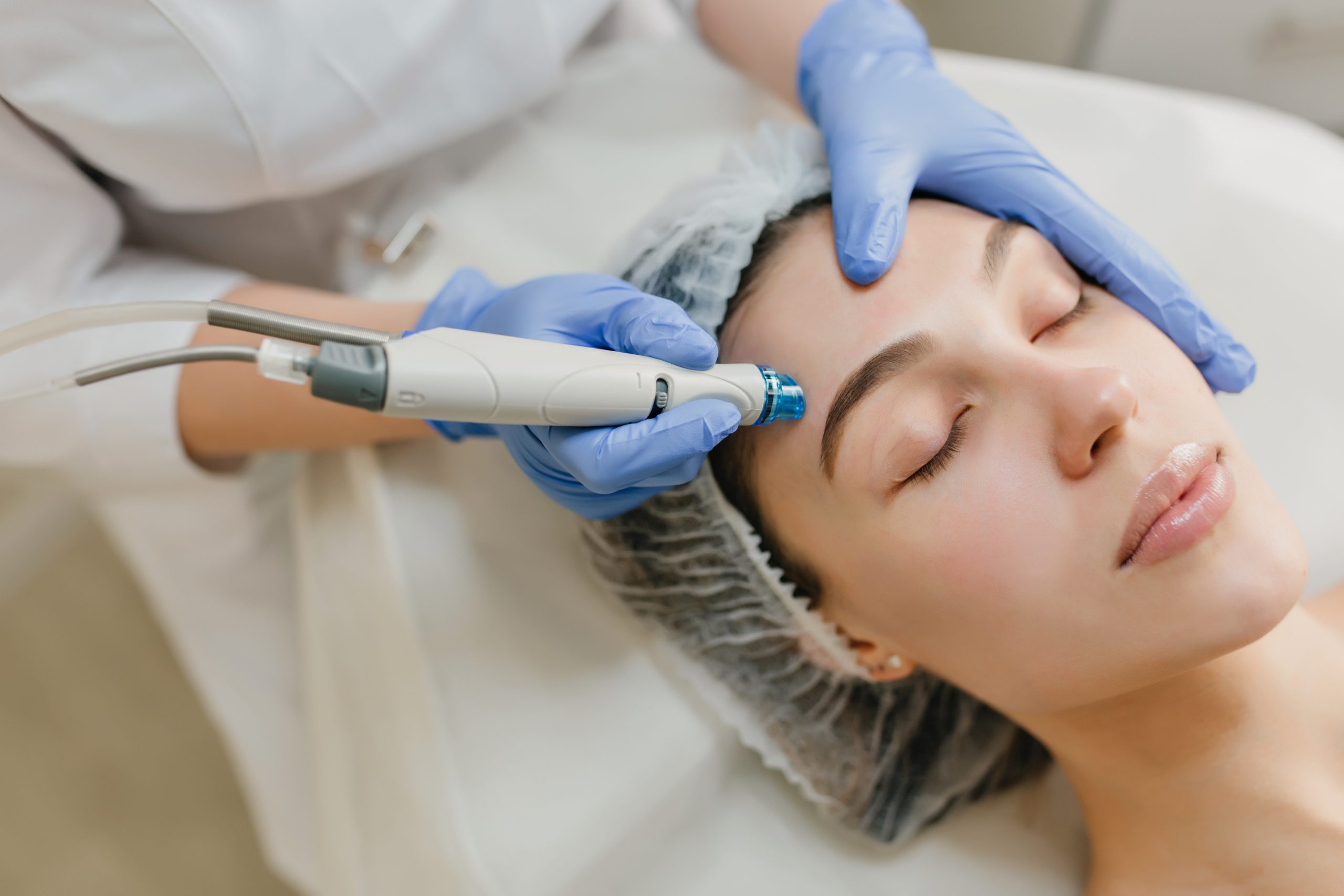 Dermapen 4 Treatment