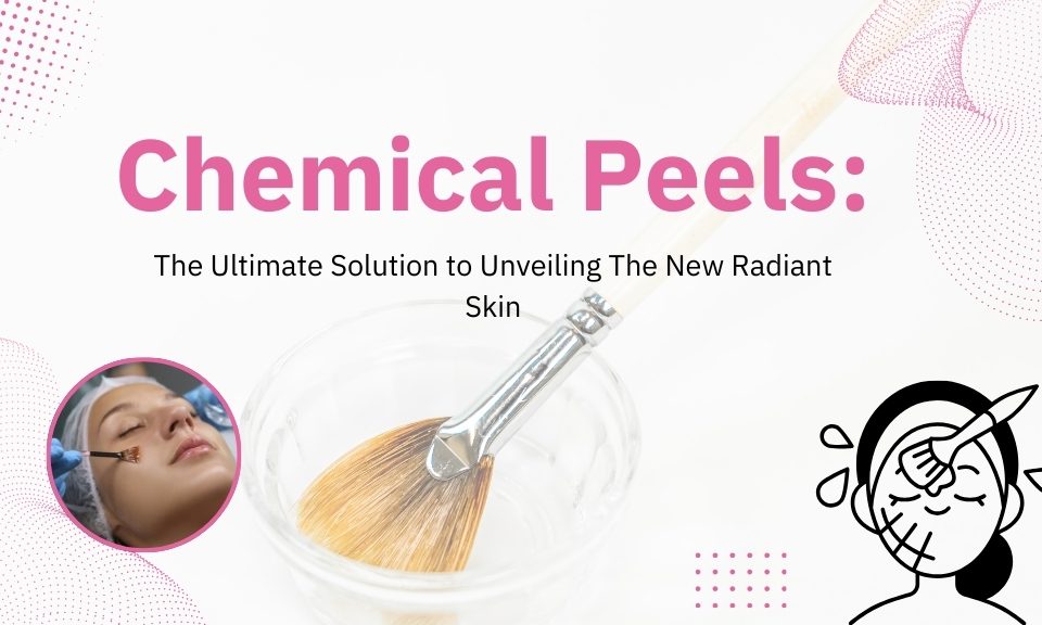 Chemical Peels