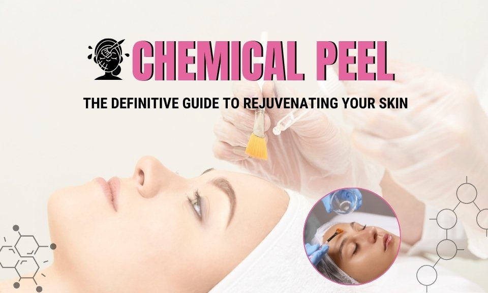 Chemical Peel