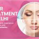 Filler Treatment In Delhi