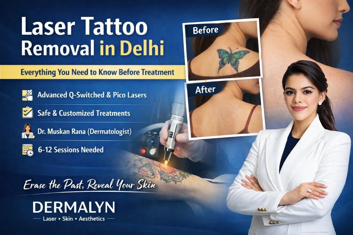 Laser Tattoo Removal in Delhi