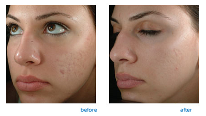 Co2-before-and-after-pic2