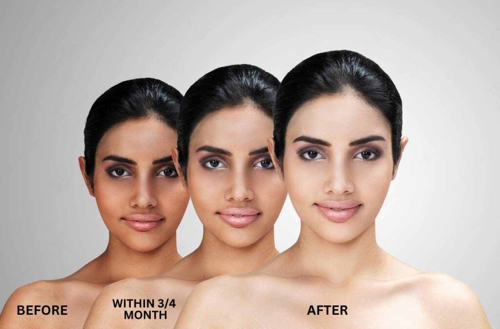 Skin Lightening Treatment